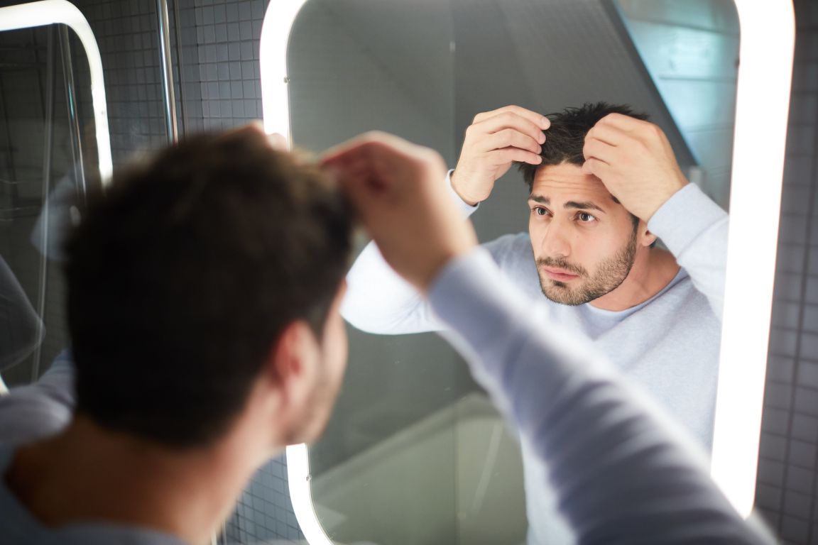 Man suffering from hair loss